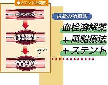 石垣ゆるのブログ 13年3月