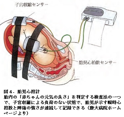 耳寄りな心臓の話（66話）『揺らぎなき末期の心臓』｜はあと文庫｜心日本心臓財団刊行物｜公益財団法人 日本心臓財団