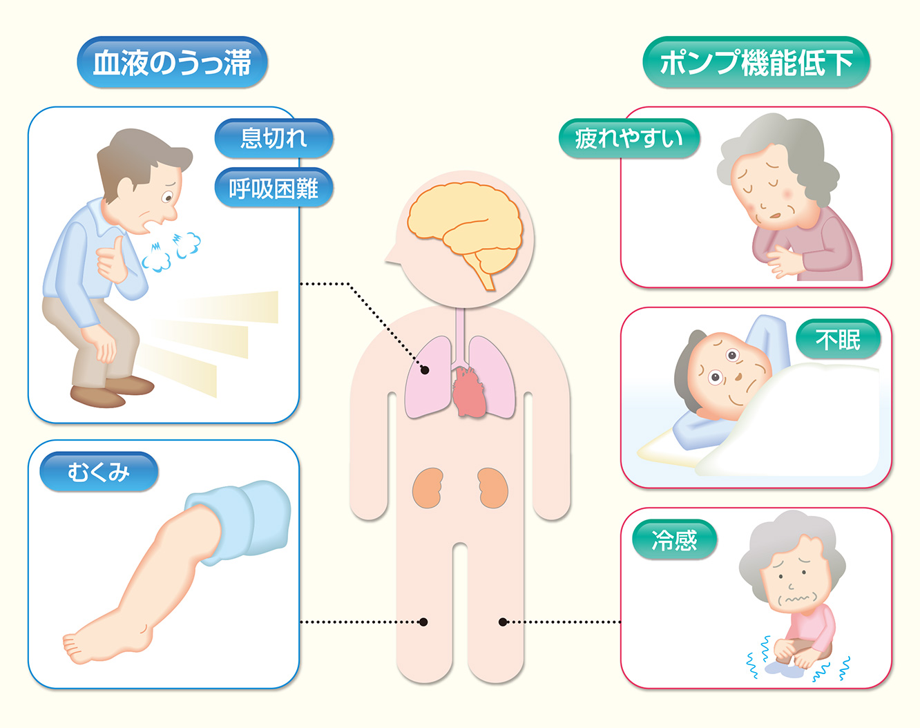 心不全 死ぬ 間際