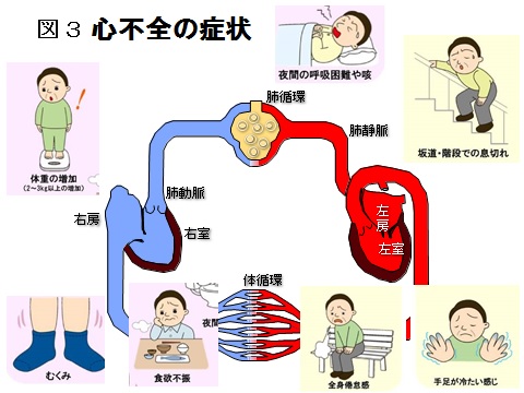 心不全はどんな病気か | 今月のトピックス | 公益財団法人 日本心臓財団